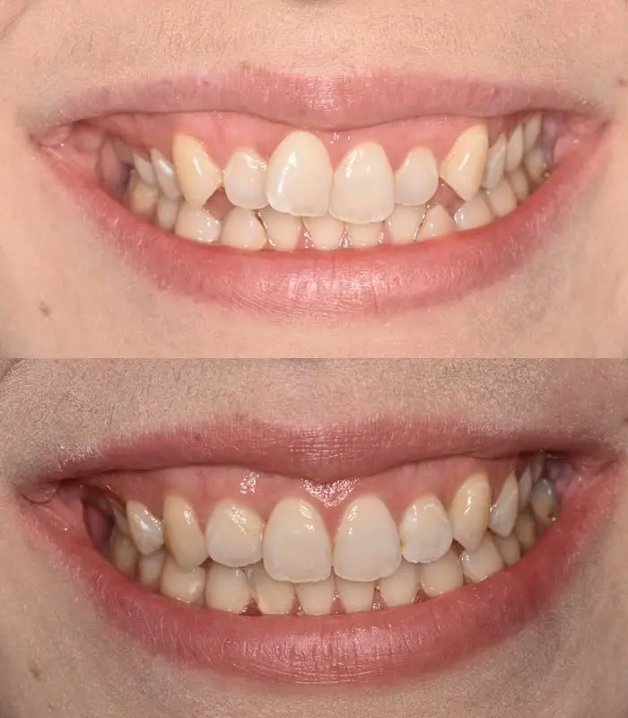 Jane : orthodontics